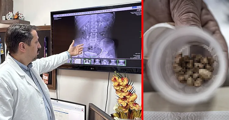 31 yaşındaki kadın yıllarca bu ağrıyla yaşadı! Ameliyata giren doktor bile şaşırdı