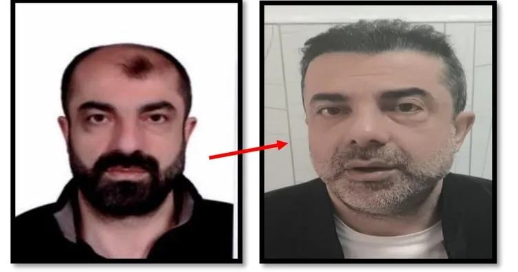 Ankara’da şaşkına çeviren olay! Estetikle kendisini kardeşine benzeten azmettirici yakalandı