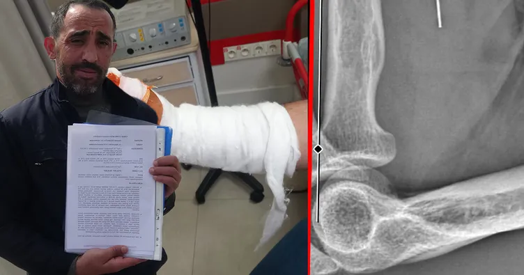 Kocaeli’de akılalmaz olay! Bayramda kesilen parmağı hayatını kararttı: Başına gelmeyen kalmadı!